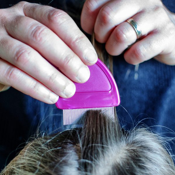 Things to know about head lice