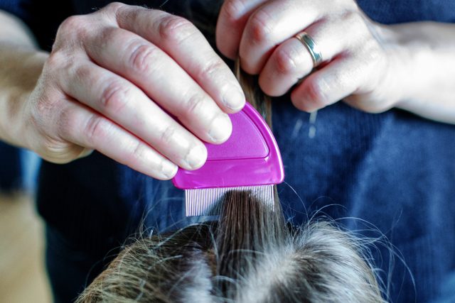 Things to know about head lice